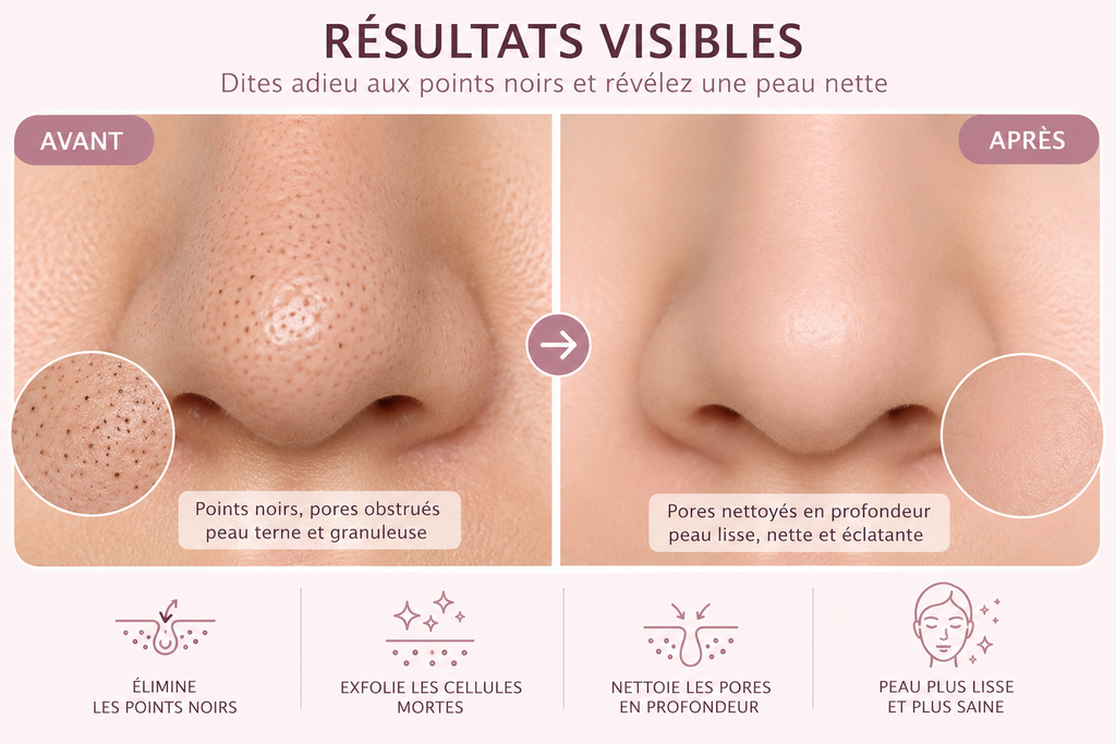 Puryvé™ Pro — Purificateur de Pores & Anti-Points Noirs